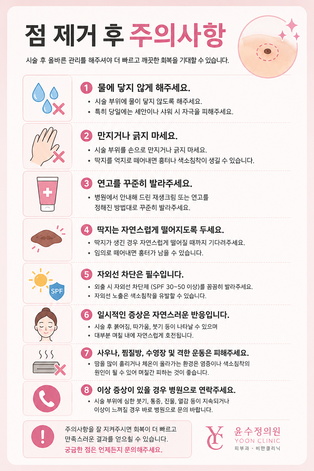 점제거 주의사항